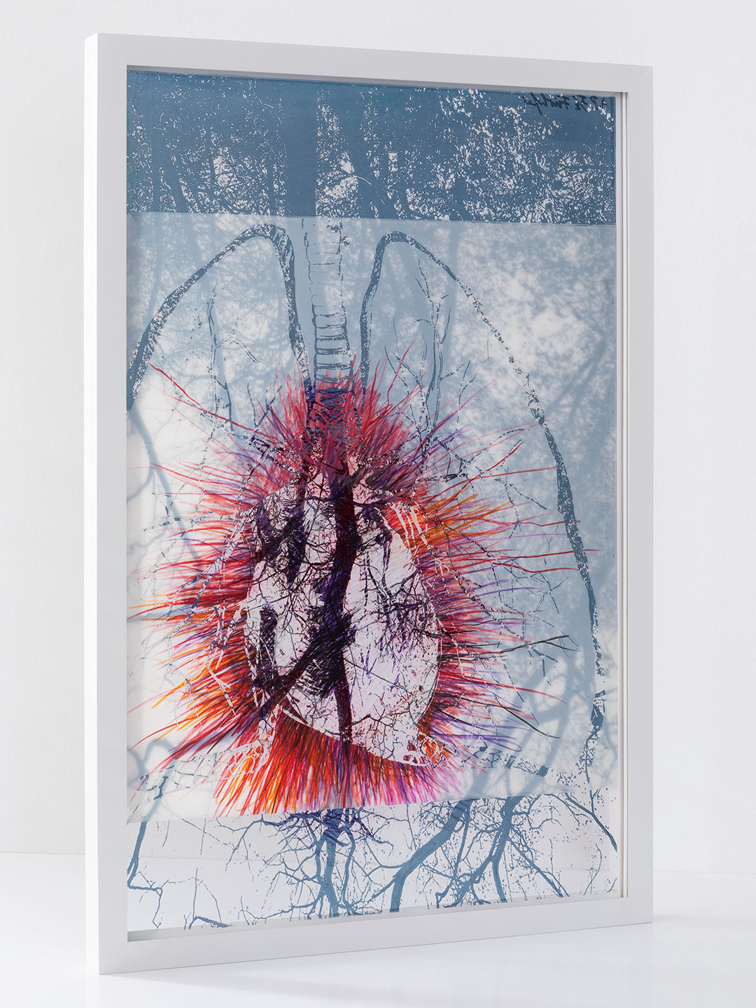 IV – from X-Rays of Sunlight“