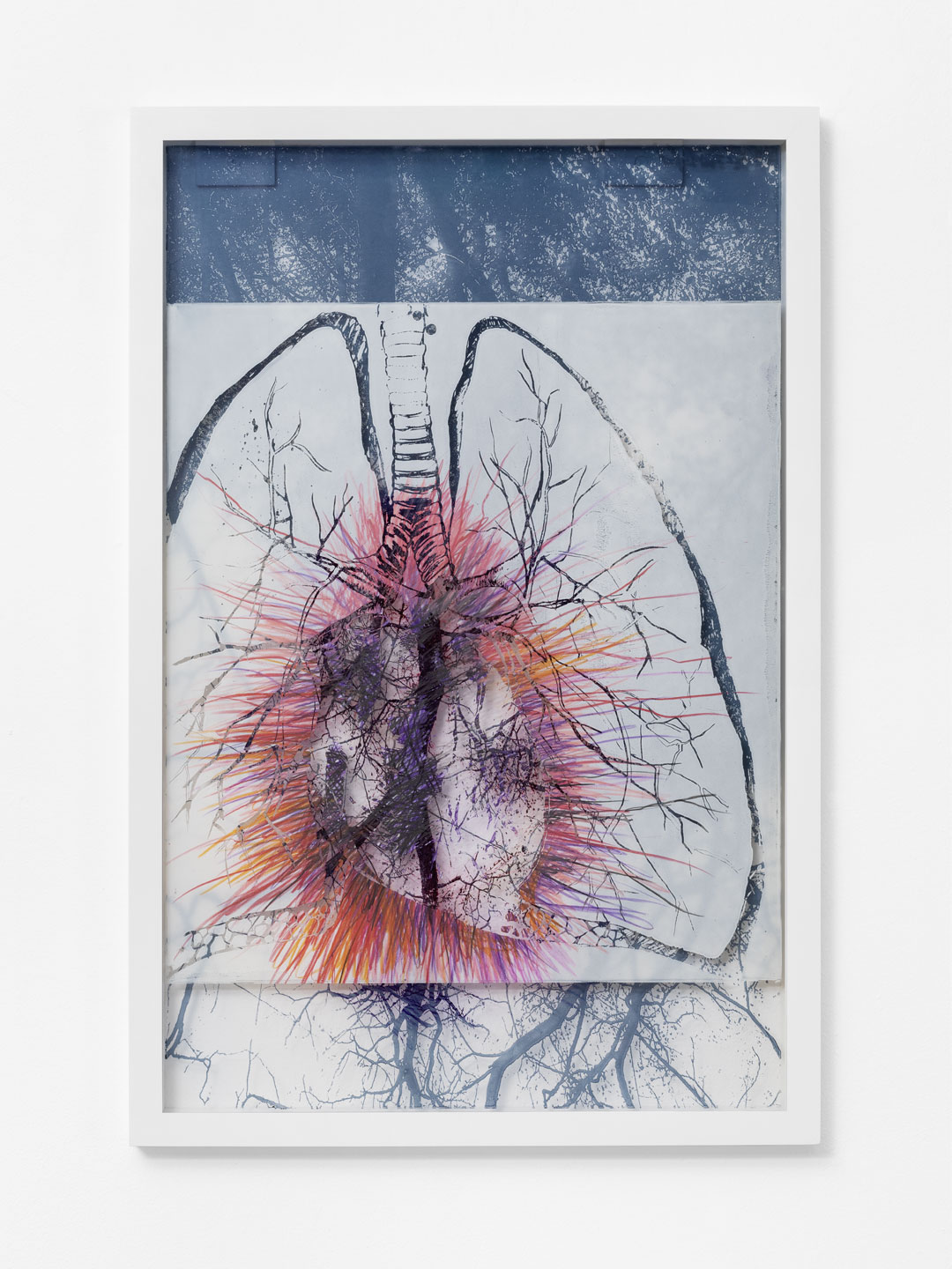 IV – from X-Rays of Sunlight“