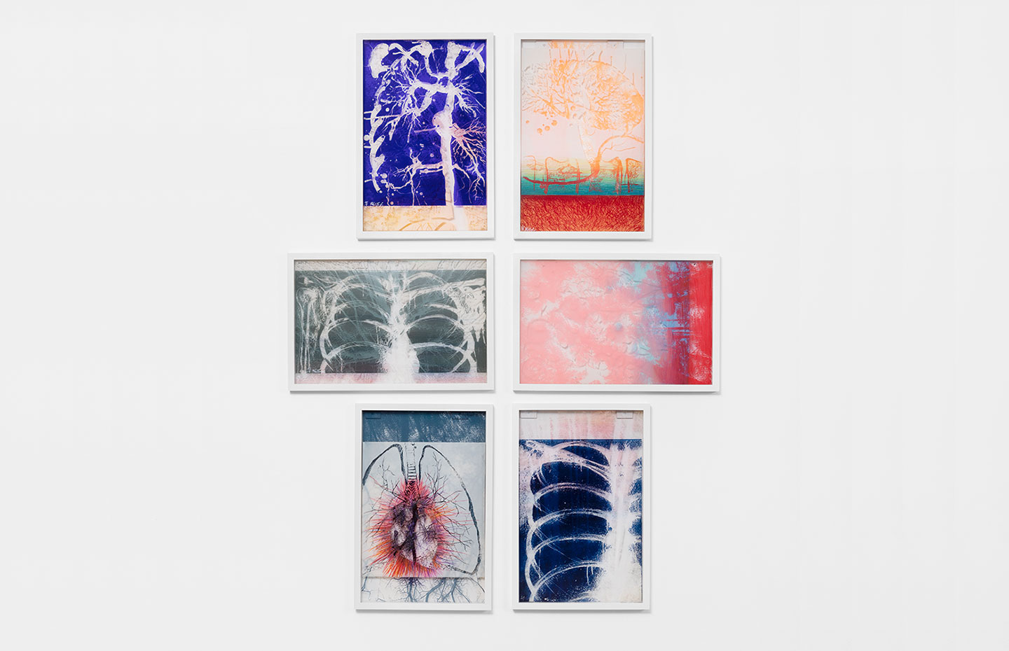 V – from X-Rays of Sunlight“